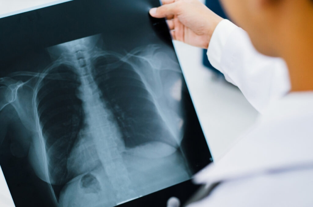 ALARMANTNO U NOVOM PAZARU I TUTINU: Lekari upozoravaju – Građani ignorišu vakcinaciju protiv gripa! ALARMANTNO U NOVOM PAZARU I TUTINU: Lekari upozoravaju – Građani ignorišu vakcinaciju protiv gripa!