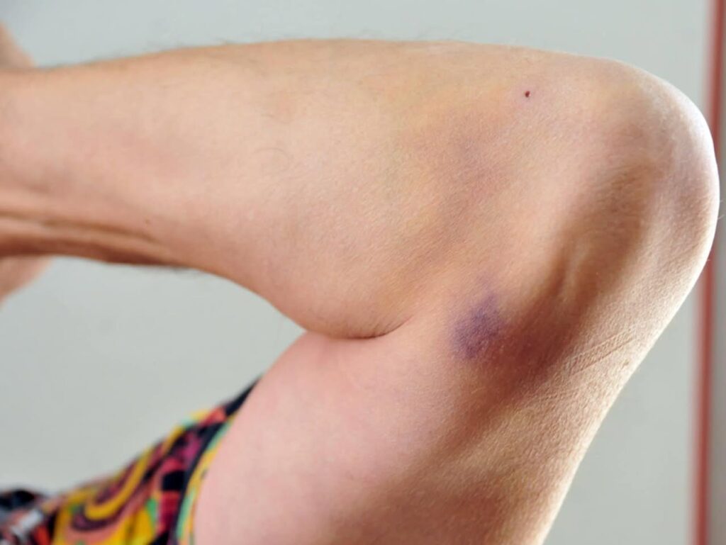 PAUČINAC: STRAH I TREPET, ŠTA SE DEŠAVA U NOVOM PAZARU? PAUČINAC: STRAH I TREPET, ŠTA SE DEŠAVA U NOVOM PAZARU?