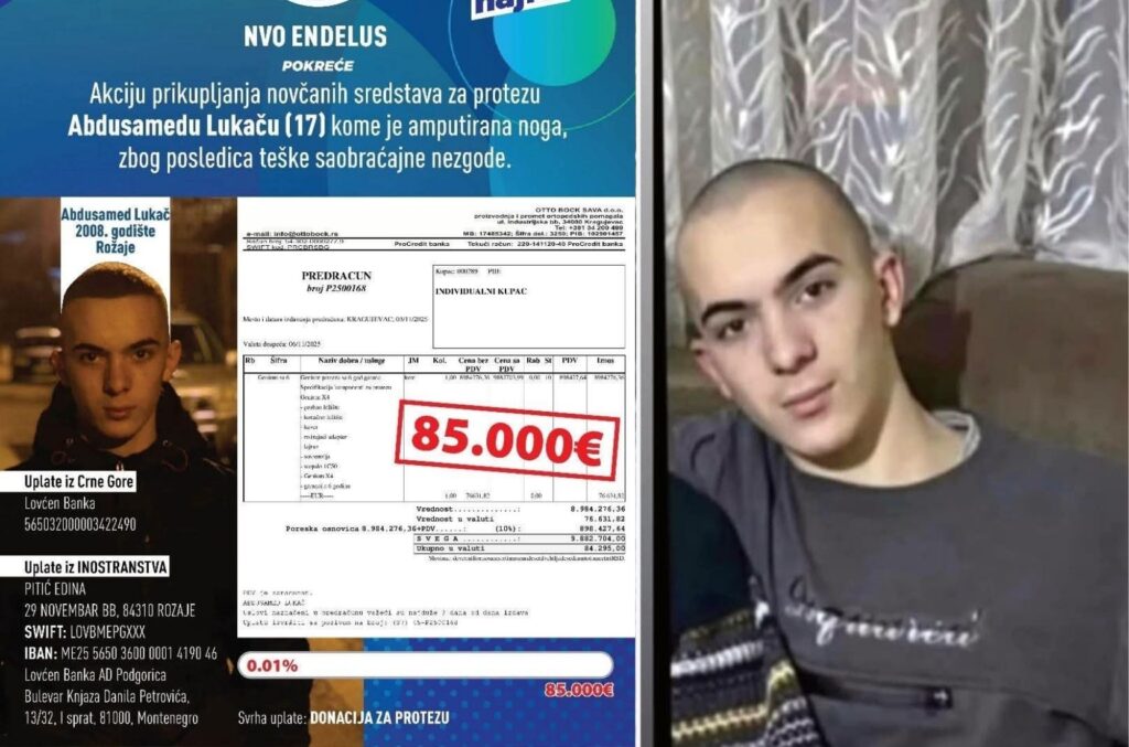 Rožajski tinejdžer Abdusamed Lukač treba protezu: Pokrenuta humanitarna akcija „Budi dio hajra“ Rožajski tinejdžer Abdusamed Lukač treba protezu: Pokrenuta humanitarna akcija „Budi dio hajra“